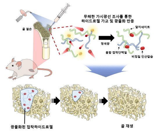 포스텍은 가시광선을 이용해 가시광선을 이용해 골 이식재 없이 뼈 재생과 접착력을 동시에 구현하는 '골 재생용 주사형 접착 하이드로젤'을 개발했다. 포스텍 제공